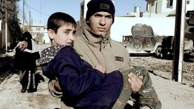 Mohammed burned his leg with hot water. His mother brought him to a special forces-run clinic for first aid because there is no medical centre nearby.