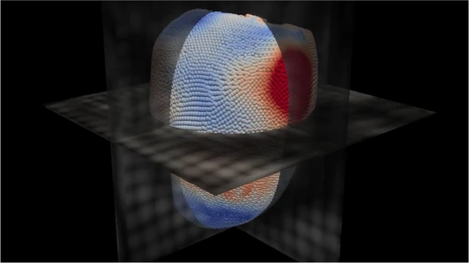 這個人工智能軟件通過一個虛擬的心臟來預測死亡危險
