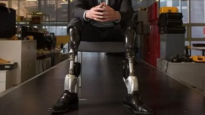 ศาสตราจารย์ฮิวจ์ เฮอร์ เชื่อว่าโลกมาถึงจุดเปลี่ยนผ่านสำคัญในด้านเทคโนโลยีอวัยวะเทียม