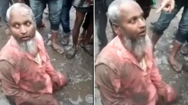 ټپي شوی شوکت علي په روغتون کې بستر شوی دی