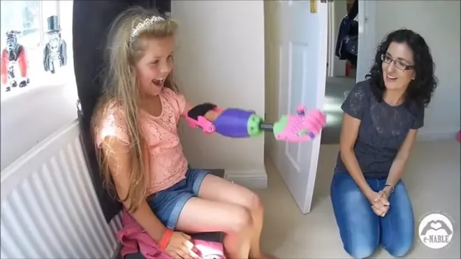 يد بطباعة ثلاثية الأبعاد تمنح الأمل للمبتورين