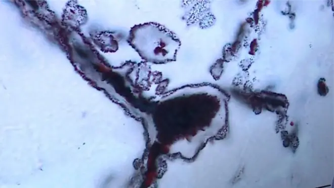 Bu filamentlerin yapısı modern filamentlere benziyor.