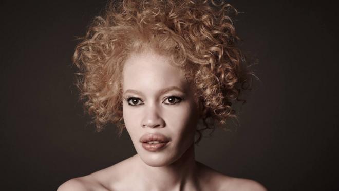 Diandra Forrest est le premier mannequin albinos égérie d'une grande marque de beauté.