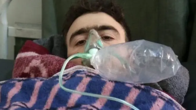 ماشومان د ګازو له کبله د ساه لنډۍ له ستونزو کړېږي