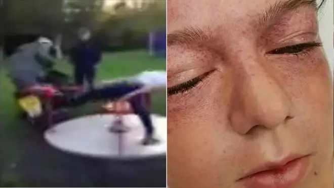 Composite image of a still from the video and a picture of injured Tyler Broom