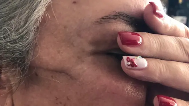 Mi tía se quedó a oscuras. La bala apagó la luz de sus ojos. "Lo que más me duele es que no veré crecer a mi nieto", dice.