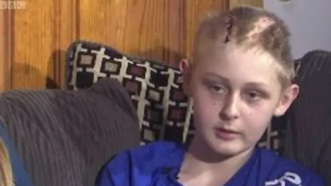 Причіп, у якому їхав Трентон Маккінлі, перевернувся і впав йому на голову.