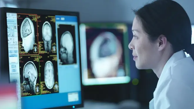 أشعة على الدماغ