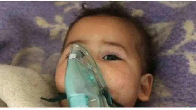 කුඩා දරුවන් ඇතුළු විශාල පිරිසක් හුස්ම ගැනීම අසීරුව පීඩා විඳිමින්