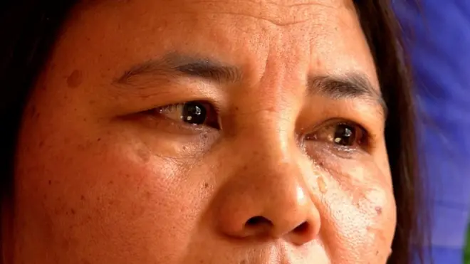 दाइलाई मिर्गौला दिने बहिनी