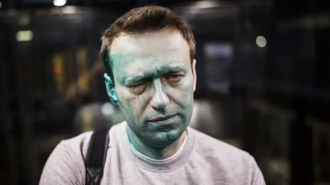 После того, как Алексея Навального облили зеленкой, его правый глаз потерял 80% зрения