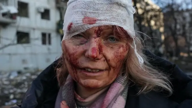 سيدة أوكرانية مصابة