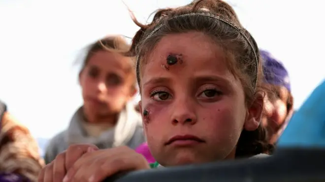 Сирийская девочка