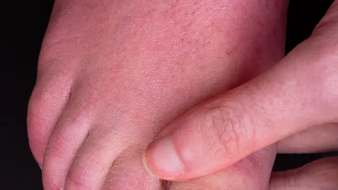 Ковидные пальцы