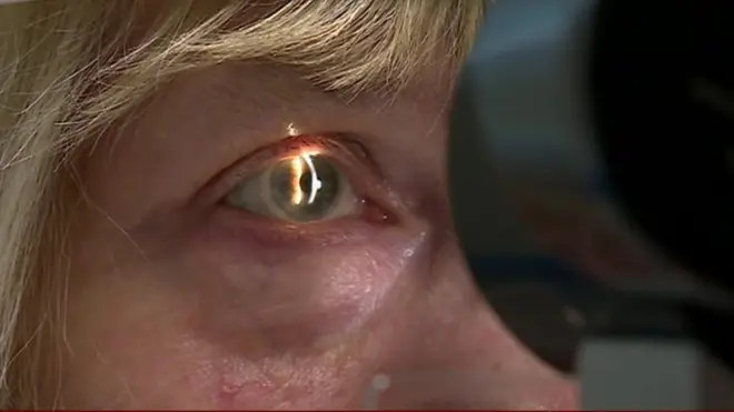 آیا ممکن است کامپیوترها جای متخصصان برجسته چشم را بگیرند؟