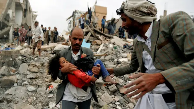 A man carries a wounded child after a Saudi-led airstrike that killed eight members of her family in Sanaa, August 2017