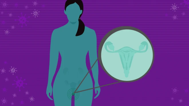 Diagram of woman with cervix pointed out
