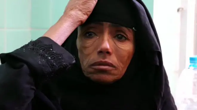 Dhaabbatni biyyoota gamtoomani Yamanitti namoonni miiliyoona 13 ta'an beelaaf saaxilamuu akeekkachiise