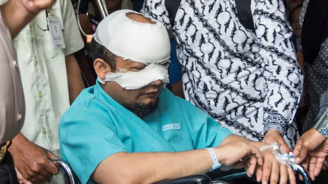 Novel Baswedan hingga saat ini masih dirawat di salah satu rumah sakit di Singapura.