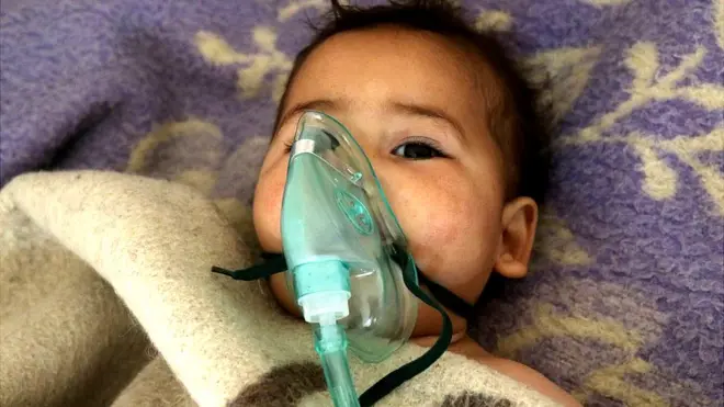 सीरिया के ख़ान शेख़ून में चार अप्रैल 2017 को हुए केमिकल अटैक की चपेट में आए बच्चे की तस्वीर