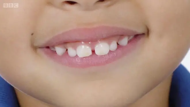 teeth
