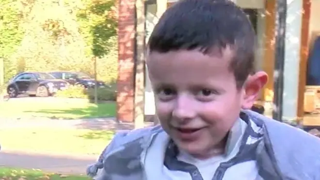 Hassan tiene piel de mariposa desde que tenía apenas unos días de vida.