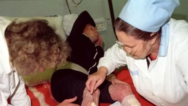 Чернобиль ҳалокати жабрдийдалари