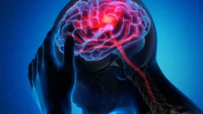 የጭንቅላት ምስል