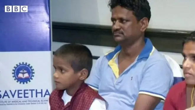 Le petit garçon de 7 ans a souffert pendant plus de quatre ans de sa mâchoire enflée.