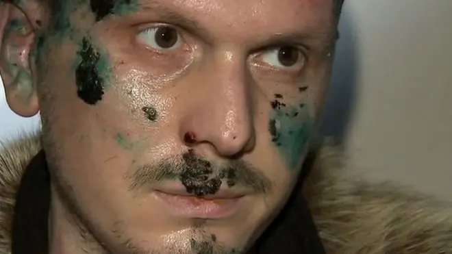 File picture showing Adam Osmayev, accused of trying to kill Russia's President Putin, 30 October 2017