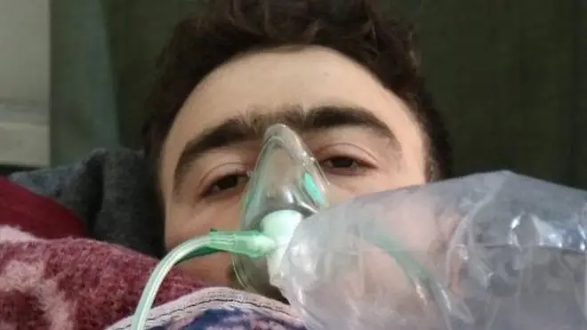 کیمیائی ہتھیار سے متاثرین کو چکر آتے ہیں، قہ ہوتی ہے اور منہ میں جھاگ بنتے ہیں