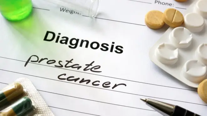 В год в Великобратини рак простаты диагностируют у 46 тысяч мужчин