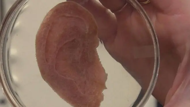 عالم كندي يصنع أذنا بشرية من التفاح