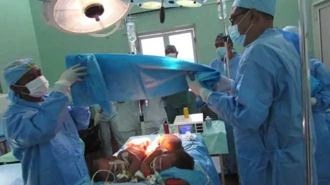 A en croire les autorités, il n'est plus nécessaire d'aller à l'étranger, car le pays dispose d'un matériel moderne et d'un personnel compétent capable de réaliser des opérations chirurgicales délicates.