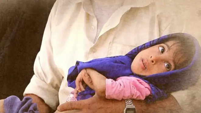 Le Yémen touché par une épidémie de diphtérie