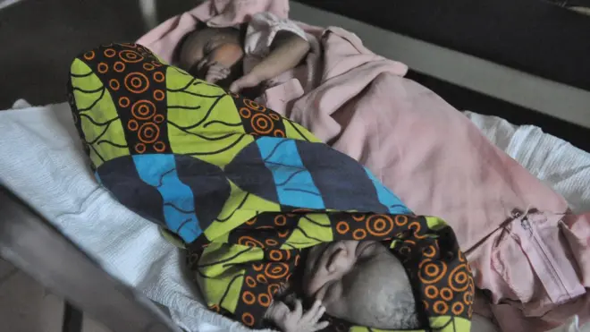 ụmụ ejịma nọ n'elu akwa ndịna