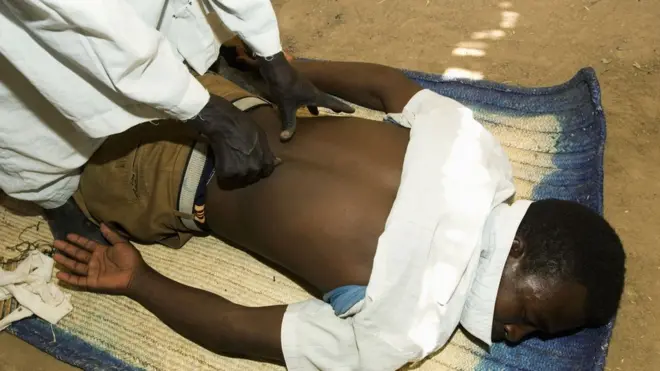 Chirurgie régulière dans la campagne à l'extérieur de Khartoum, la capitale du pays, un guérisseur traite un patient pour un problème de dos