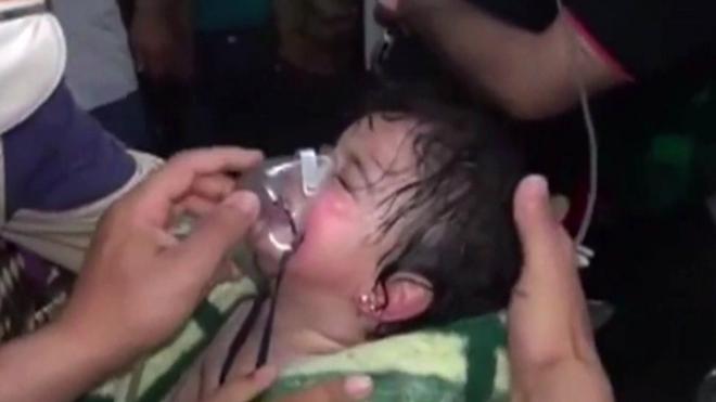 A Syrian infant girl is treated after an alleged chemical weapons attack