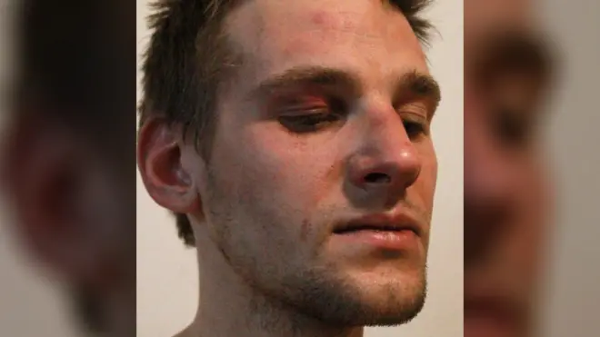 По словам Капустина, вечером 25 января сотрудники ФСБ затолкнули его в машину и в ней пытали электрошокером