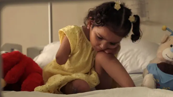 두 팔과 한쪽 다리를 잃은 하비바