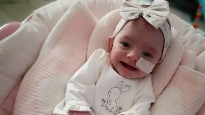 770 gram olarak doğan Ivy Worsley şimdi 9 aylık sağlıklı bir bebek