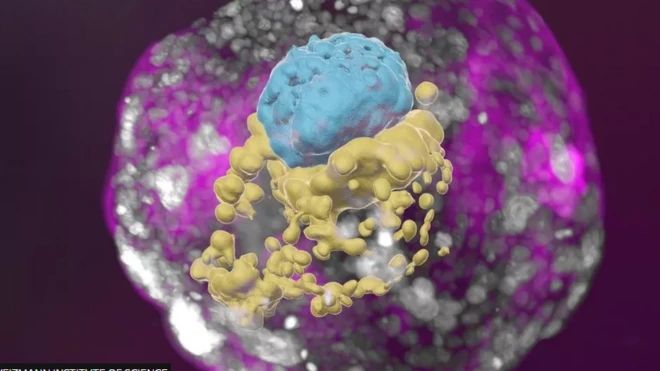 Aworan ọlẹ ọmọ