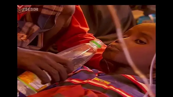 Mtoto akipewa maji hospitalini Somalia