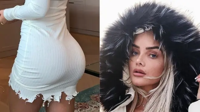 Sophie Elise a subi une opération pour grossir ses fesses