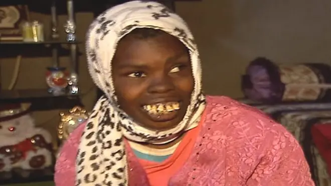 الضحايا المنسيون لتجارب فرنسا النووية في الجزائر