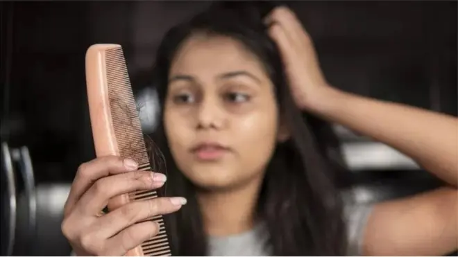 ویښته توېیدل