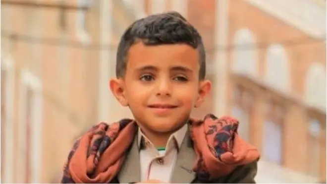 بصوته الساحر طفل يمني يخطف الأسماع في شوارع صنعاء