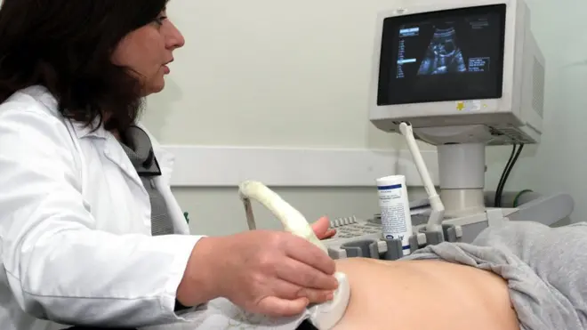 Belanda mengatakan bantuannya atas lembaga-lembaga perempuan berhasil mencegah enam juta kehamilan yang tidak direncanakan dan setengah juta aborsi.