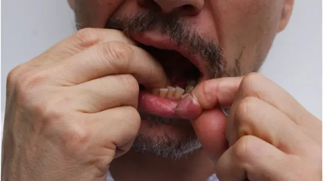 Можно ли с уверенностью утверждать, что чистка зубов с помощью нити полезна? Раньше ученые говорили - да, теперь - сомневаются...