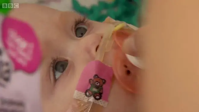 Vanellope Wilkins sinh ra với tim nằm ngoài cơ thể